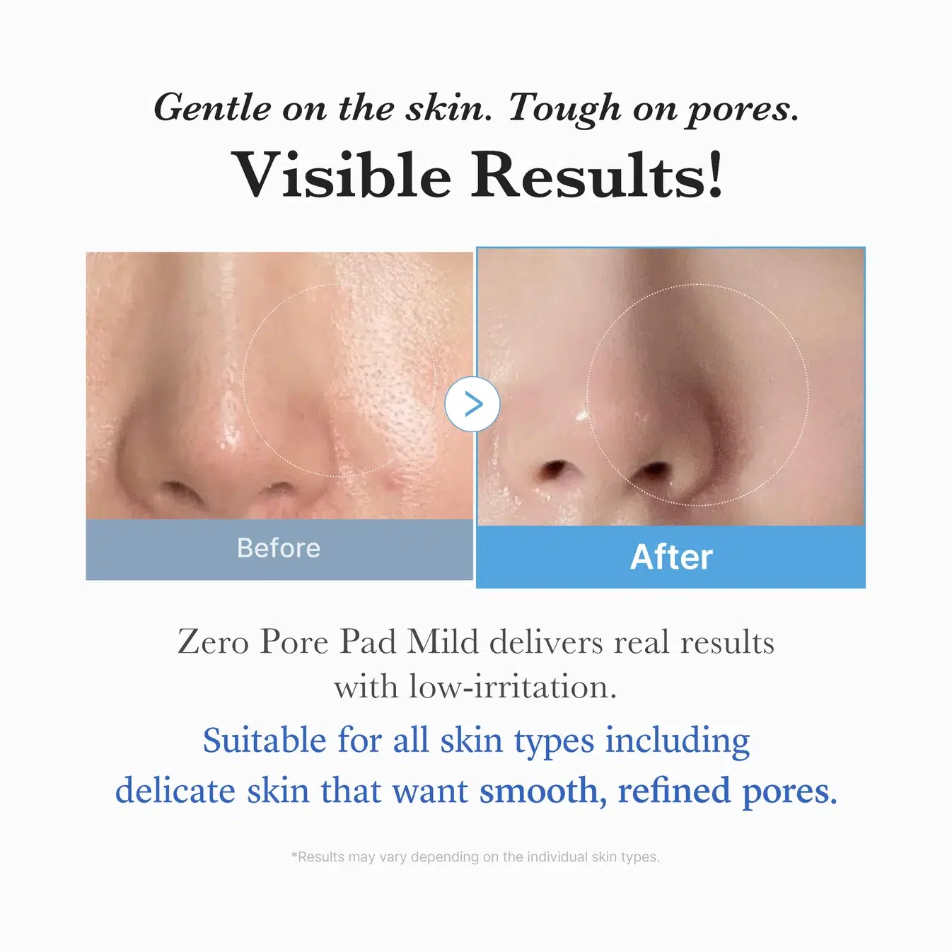 Zero pore pad mild - medicube 155ml - Image 5